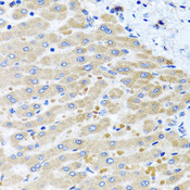 DARS2 Antibody - Immunohistochemistry of paraffin-embedded human liver injury tissue.