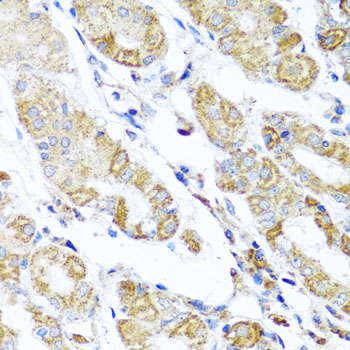 DARS2 Antibody - Immunohistochemistry of paraffin-embedded human stomach tissue.