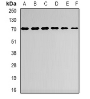 DARS2 Antibody - Western blot analysis of AspRS expression in NCIH460 (A); U251 (B); MCF7 (C); BT474 (D); mouse liver (E); mouse heart (F) whole cell lysates.