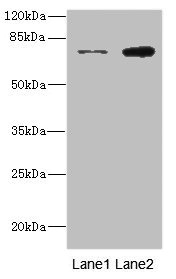 DARS2 Antibody - Western blot All Lanes: DARS2 antibody at 10ug/ml Lane 1: A549 whole cell lysate Lane 2: MCF7 whole cell lysate Secondary Goat polyclonal to rabbit IgG at 1/10000 dilution Predicted band size: 74 kDa Observed band size: 74 kDa