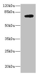 DARS2 Antibody - Western blot All lanes: DARS2 antibody at 10µg/ml + MCF-7 whole cell lysate Secondary Goat polyclonal to rabbit IgG at 1/10000 dilution Predicted band size: 74 kDa Observed band size: 74 kDa