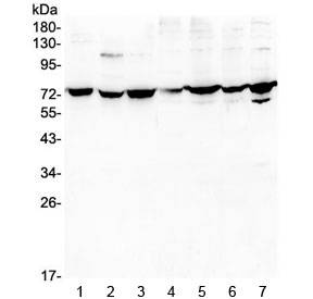 DARS2 Antibody - Western blot testing of human 1) A431, 2) K562, 3) A549, 4) PC-3, 5) U-2 OS, 6) Caco-2 and 7) HEK293 lysate with DARS2 antibody at 0.5ug/ml. Predicted molecular weight ~74 kDa.