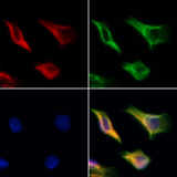 DARS2 Antibody - Staining HeLa cells by IF/ICC. The samples were fixed with PFA and permeabilized in 0.1% Triton X-100, then blocked in 10% serum for 45 min at 25°C. Samples were then incubated with primary Ab(1:200) and mouse anti-beta tubulin Ab(1:200) for 1 hour at 37°C. An AlexaFluor594 conjugated goat anti-rabbit IgG(H+L) Ab(1:200 Red) and an AlexaFluor488 conjugated goat anti-mouse IgG(H+L) Ab(1:600 Green) were used as the secondary antibod