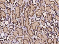 DARS2 Antibody - Immunochemical staining of human DARS2 in human kidney with rabbit polyclonal antibody at 1:100 dilution, formalin-fixed paraffin embedded sections.