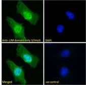DAT1 / LMO3 Antibody - Goat anti-LIM domain only 3 / lmo3 Antibody Immunofluorescence analysis of paraformaldehyde fixed HeLa cells, permeabilized with 0.15% Triton. Primary incubation 1hr (10ug/ml) followed by Alexa Fluor 488 secondary antibody (2ug/ml), showing nuclear and cytoplasmic staining. The nuclear stain is DAPI (blue). Negative control: Unimmunized goat IgG (10ug/ml) followed by Alexa Fluor 488 secondary antibody (2ug/ml).