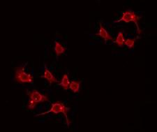 DAT1 / LMO3 Antibody - Staining HeLa cells by IF/ICC. The samples were fixed with PFA and permeabilized in 0.1% Triton X-100, then blocked in 10% serum for 45 min at 25°C. The primary antibody was diluted at 1:200 and incubated with the sample for 1 hour at 37°C. An Alexa Fluor 594 conjugated goat anti-rabbit IgG (H+L) Ab, diluted at 1/600, was used as the secondary antibody.
