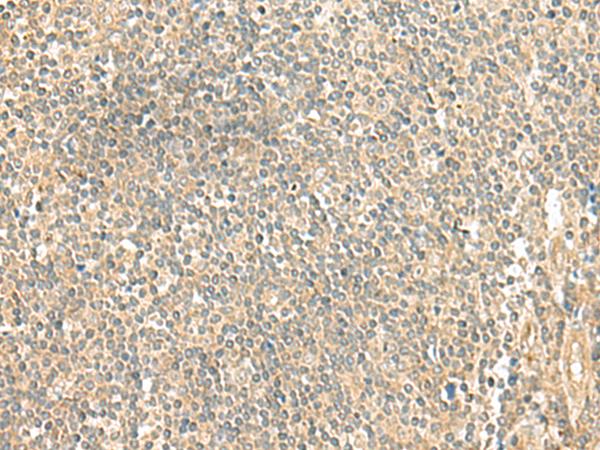 DAT1 / LMO3 Antibody - Immunohistochemistry of paraffin-embedded Human tonsil tissue  using LMO3 Polyclonal Antibody at dilution of 1:50(×200)