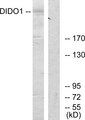DATF1 / DIDO1 Antibody - Western blot analysis of lysates from 293 cells, using DIDO1 Antibody. The lane on the right is blocked with the synthesized peptide.