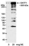 DATF1 / DIDO1 Antibody - Detection of human DATF by Western Blot. Samples: Nuclear extract (5 and 20 ug) from HeLa cells. Antibody: Affinity purified rabbit anti-DATF1 antibody used at 0.01 ug/ml. Detection: Chemiluminescence with an exposure time of 15 minutes.