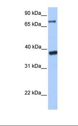 DATF1 / DIDO1 Antibody - Transfected 293T cell lysate. Antibody concentration: 1.0 ug/ml. Gel concentration: 12%.  This image was taken for the unconjugated form of this product. Other forms have not been tested.