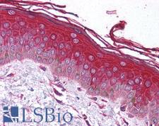DATF1 / DIDO1 Antibody - Human Skin (formalin-fixed, paraffin-embedded) stained with DIDO1 antibody LS-B1519 at 5 ug/ml followed by biotinylated goat anti-rabbit IgG secondary antibody, alkaline phosphatase-streptavidin and chromogen.  This image was taken for the unconjugated form of this product. Other forms have not been tested.