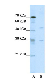 DATF1 / DIDO1 Antibody - DIDO1 / DATF1 antibody Western blot of Jurkat lysate. This image was taken for the unconjugated form of this product. Other forms have not been tested.