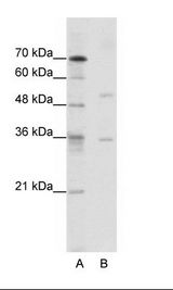 DATF1 / DIDO1 Antibody - A: Marker, B: Jurkat Cell Lysate.  This image was taken for the unconjugated form of this product. Other forms have not been tested.