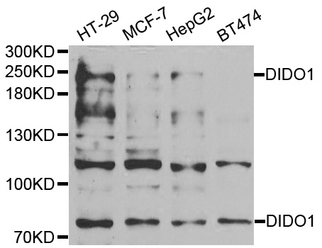 DATF1 / DIDO1 Antibody - Western blot analysis of extracts of various cell lines.