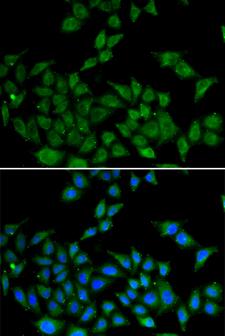 DATF1 / DIDO1 Antibody - Immunofluorescence analysis of HeLa cells.