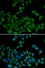 DATF1 / DIDO1 Antibody - Immunofluorescence analysis of HeLa cells using DIDO1 Polyclonal Antibody.
