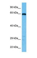 DATF1 / DIDO1 Antibody - Western blot of DIDO1 Antibody with human Jurkat Whole Cell lysate.  This image was taken for the unconjugated form of this product. Other forms have not been tested.