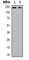 DATF1 / DIDO1 Antibody - Western blot analysis of DIDO1 expression in HepG2 (A); Jurkat (B) whole cell lysates.