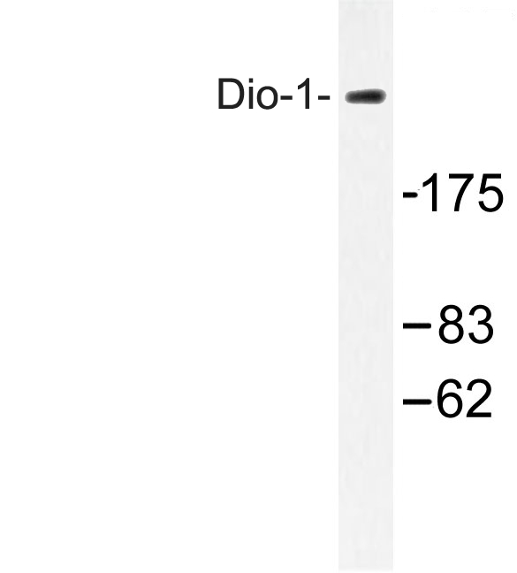 DATF1 / DIDO1 Antibody - Western blot of DATF1 / DIDO1(S186) pAb in extracts from 293 cells.