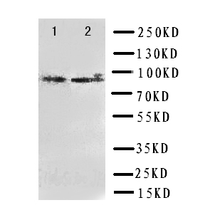 DAXX Antibody - WB of DAXX antibody. Lane 1: HELA Cell Lysate. Lane 2: COLO320 Cell Lysate.