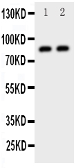 DAXX Antibody - Anti-Daxx antibody, Western blotting All lanes: Anti Daxx at 0.5ug/ml Lane 1: HELA Whole Cell Lysate at 40ug Lane 2: COLO320 Whole Cell Lysate at 40ug Predicted bind size: 81KD Observed bind size: 81KD