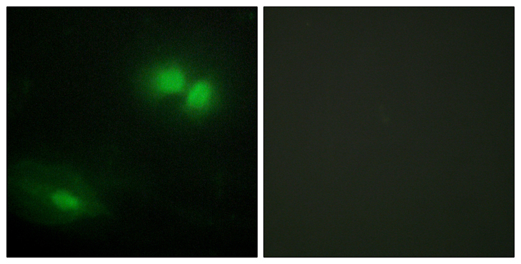 DAXX Antibody - Immunofluorescence analysis of HeLa cells, using DAXX Antibody. The picture on the right is blocked with the synthesized peptide.