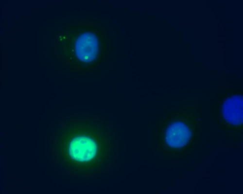 DAXX Antibody - Immunofluorescence staining of Daxx in transfected HeLa human cervix carcinoma cell line.  Myc Daxx (green) was stained with anti-human Daxx (DAXX-01), nuclei were stained with DAPI (blue).    A - nuclear localization of Daxx in HeLa cells transfected with pCDNA3-MycDaxx  B - HeLa cells were co-transfected with pCDNA3-MycDaxx and pCDNA3-ASK1HA, which led to translocation of Daxx from nucleus to cytoplasm