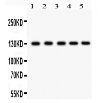 DAXX Antibody - DAXX antibody Western blot. All lanes: Anti DAXX at 0.5 ug/ml. Lane 1: Rat Testis Tissue Lysate at 50 ug. Lane 2: A431 Whole Cell Lysate at 40 ug. Lane 3: HELA Whole Cell Lysate at 40 ug. Lane 4: HUT Whole Cell Lysate at 40 ug. Lane 5: HEPA Whole Cell Lysate at 40 ug. Predicted band size: 81 kD. Observed band size: 130 kD.