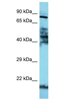 DAXX Antibody - DAXX antibody Western Blot of HepG2. Antibody dilution: 1 ug/ml.  This image was taken for the unconjugated form of this product. Other forms have not been tested.