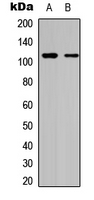 DAXX Antibody - Western blot analysis of DAXX expression in HeLa (A); A549 (B) whole cell lysates.