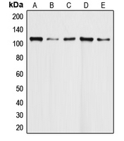 DAXX Antibody - Western blot analysis of DAXX expression in HeLa (A); Molt4 (B); Ramos (C); K562 (D); HEK293T (E) whole cell lysates.