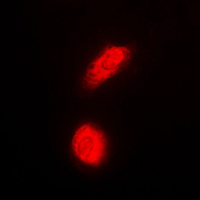 DAXX Antibody - Immunofluorescent analysis of DAXX staining in HeLa cells. Formalin-fixed cells were permeabilized with 0.1% Triton X-100 in TBS for 5-10 minutes and blocked with 3% BSA-PBS for 30 minutes at room temperature. Cells were probed with the primary antibody in 3% BSA-PBS and incubated overnight at 4 C in a humidified chamber. Cells were washed with PBST and incubated with a DyLight 594-conjugated secondary antibody (red) in PBS at room temperature in the dark. DAPI was used to stain the cell nuclei (blue).
