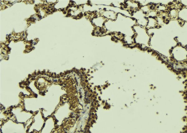 DAXX Antibody - 1:100 staining mouse lung tissue by IHC-P. The sample was formaldehyde fixed and a heat mediated antigen retrieval step in citrate buffer was performed. The sample was then blocked and incubated with the antibody for 1.5 hours at 22°C. An HRP conjugated goat anti-rabbit antibody was used as the secondary.