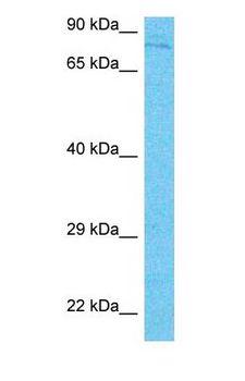 DAXX Antibody - Western blot of DAXX Antibody with human HeLa Whole Cell lysate.  This image was taken for the unconjugated form of this product. Other forms have not been tested.