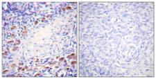 DAXX Antibody - Peptide - + Immunohistochemical analysis of paraffin-embedded human ovary tissue using Daxx (Ab-668) Antibody.