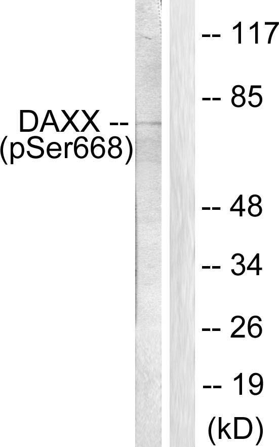DAXX Antibody - Western blot analysis of lysates from 293 cells treated with PBS 60', using Daxx (Phospho-Ser668) Antibody. The lane on the right is blocked with the phospho peptide.