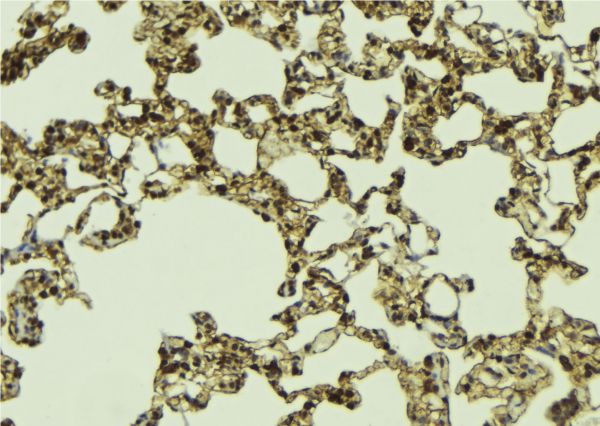 DAXX Antibody - 1:100 staining mouse lung tissue by IHC-P. The sample was formaldehyde fixed and a heat mediated antigen retrieval step in citrate buffer was performed. The sample was then blocked and incubated with the antibody for 1.5 hours at 22°C. An HRP conjugated goat anti-rabbit antibody was used as the secondary.