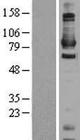 DAXX Protein - Western validation with an anti-DDK antibody * L: Control HEK293 lysate R: Over-expression lysate