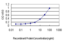 DAZ1 / DAZ Antibody - Detection limit for recombinant GST tagged DAZ1 is approximately 1 ng/ml as a capture antibody.