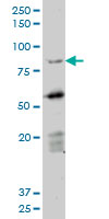 DAZ1 / DAZ Antibody - DAZ1 monoclonal antibody (M06), clone 3E3. Western blot of DAZ1 expression in Daoy.