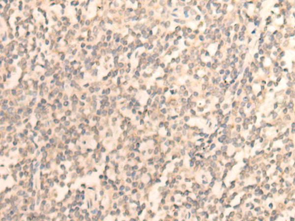 DAZ1 / DAZ Antibody - Immunohistochemistry of paraffin-embedded Human tonsil tissue  using DAZ1 Polyclonal Antibody at dilution of 1:55(×200)