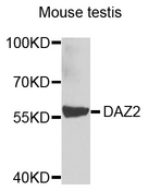 DAZ2 Antibody - Western blot analysis of extracts of mouse testis.