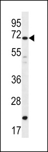 DAZ4 Antibody - DAZ4 Antibody western blot of A549 cell line lysates (35 ug/lane). The DAZ4 antibody detected the DAZ4 protein (arrow).
