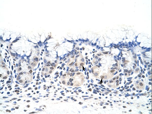 DAZ4 Antibody - DAZ4 antibody ARP40243_P050-AAF91331-DAZ4 (deleted in azoospermia 4) Antibody was used in IHC to stain formalin-fixed, paraffin-embedded human stomach.  This image was taken for the unconjugated form of this product. Other forms have not been tested.