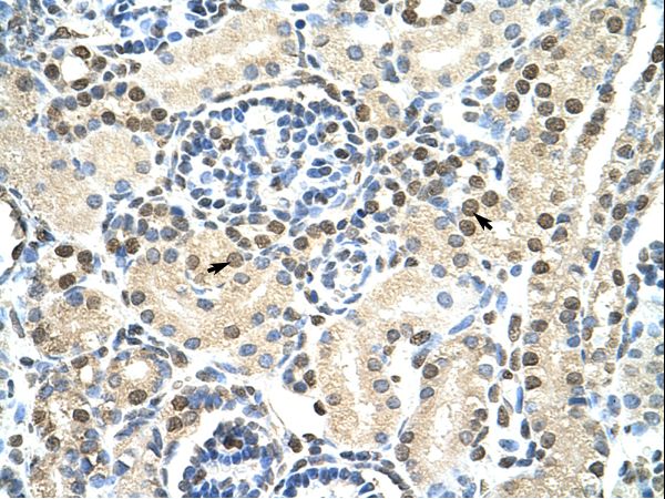 DAZAP1 Antibody - DAZAP1 antibody ARP40924_T100-NP_061832-DAZAP1 (DAZ associated protein 1) Antibody was used in IHC to stain formalin-fixed, paraffin-embedded human kidney.  This image was taken for the unconjugated form of this product. Other forms have not been tested.