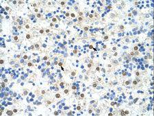 DAZAP1 Antibody - DAZAP1 antibody ARP40927_T100-NP_061832-DAZAP1 (DAZ associated protein 1) Antibody was used in IHC to stain formalin-fixed, paraffin-embedded human liver.  This image was taken for the unconjugated form of this product. Other forms have not been tested.