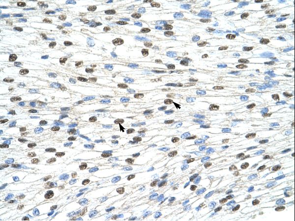 DAZAP1 Antibody - DAZAP1 antibody ARP40927_T100-NP_061832-DAZAP1 (DAZ associated protein 1) Antibody was used in IHC to stain formalin-fixed, paraffin-embedded human heart.  This image was taken for the unconjugated form of this product. Other forms have not been tested.