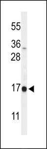 DAZAP2 Antibody - Western blot of DAZAP2 Antibody in A375 cell line lysates (35 ug/lane). DAZAP2 (arrow) was detected using the purified antibody.