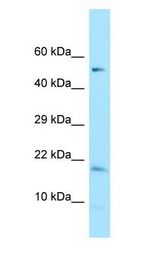 DAZAP2 Antibody - DAZAP2 antibody Western Blot of HeLa.  This image was taken for the unconjugated form of this product. Other forms have not been tested.