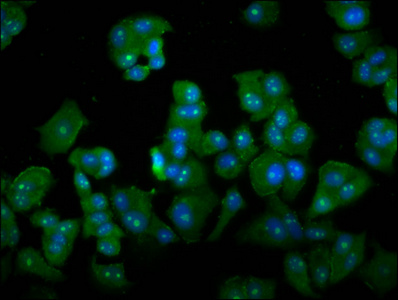 DAZAP2 Antibody - Immunofluorescence staining of MCF-7 cells diluted at 1:133, counter-stained with DAPI. The cells were fixed in 4% formaldehyde, permeabilized using 0.2% Triton X-100 and blocked in 10% normal Goat Serum. The cells were then incubated with the antibody overnight at 4°C.The Secondary antibody was Alexa Fluor 488-congugated AffiniPure Goat Anti-Rabbit IgG (H+L).